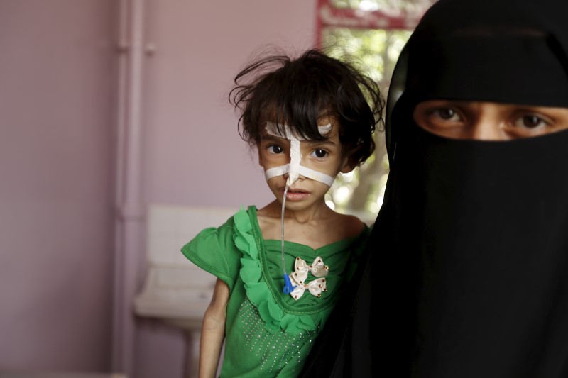 © Reuters. Woman holds her malnourished daughter at a hospital in Yemen's capital Sanaa